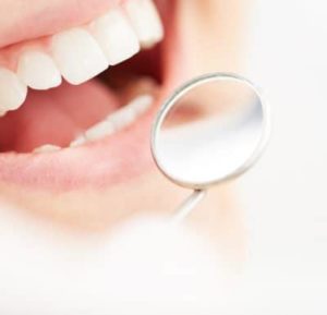 dental-filling-in-airdrie-400x385-1-300x289