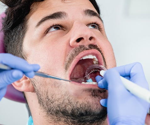 Professional teeth cleaning in Seton