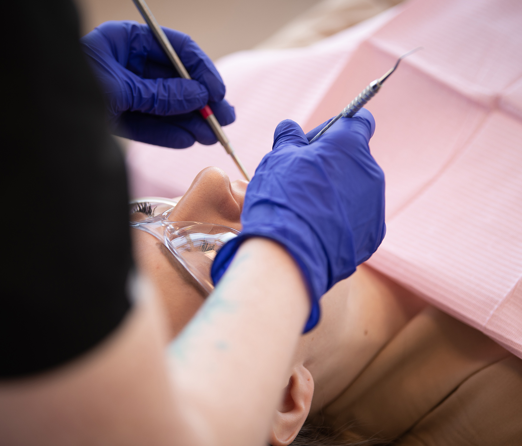 Extractions in Seton Extractions in Seton
