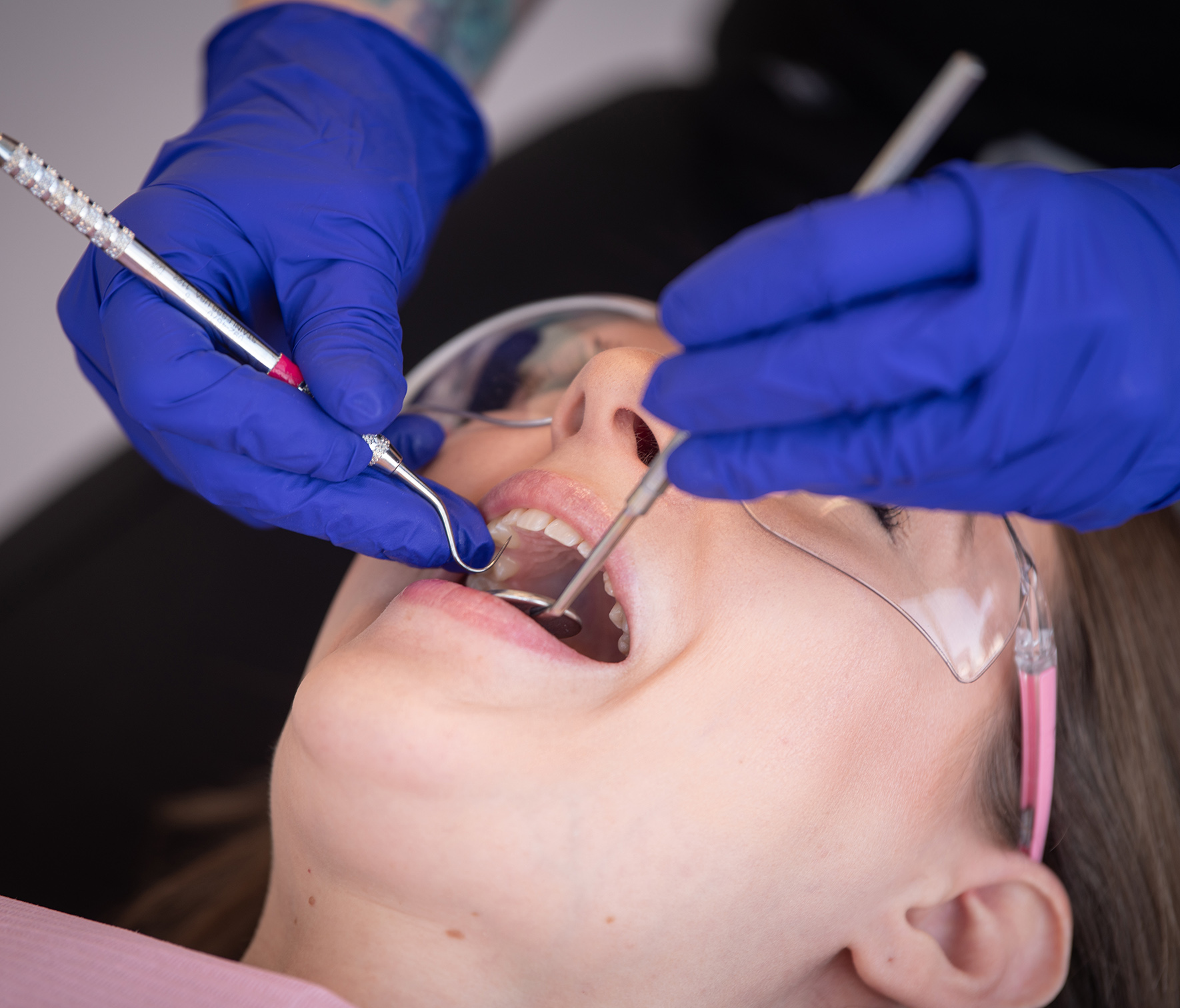 Sedation Dentistry in Seton Sedation Dentistry in Seton