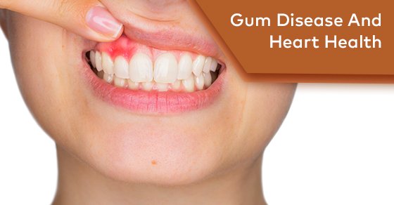 How Is Gum Disease Related To Heart Health?