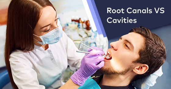 Root Canals VS Cavities