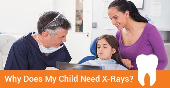 Child Dental X-Rays