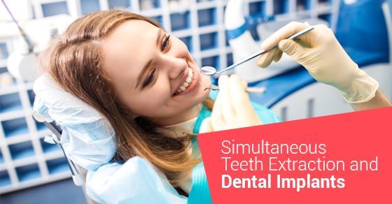 Simultaneous Teeth Extraction And Dental Implants