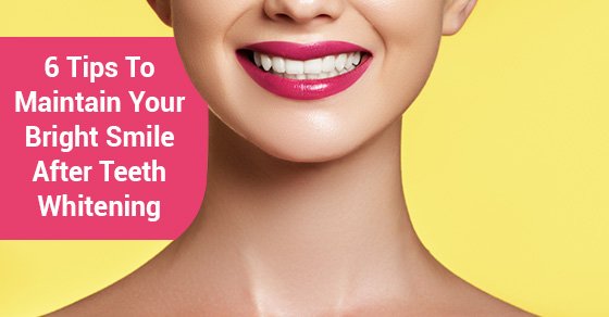 6 Tips To Maintain Your Bright Smile After Teeth Whitening