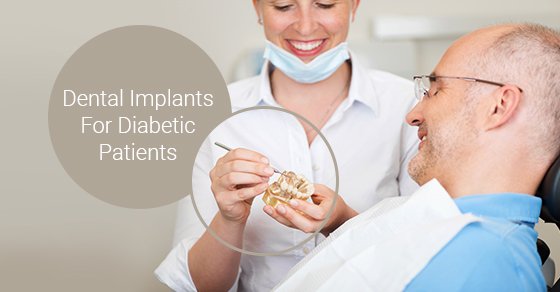 Dental Implants For Diabetic Patients