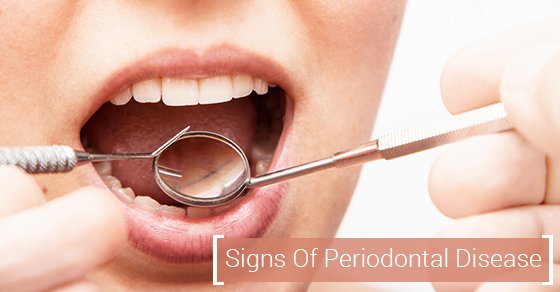 Signs Of Periodontal Disease