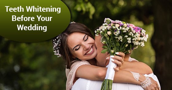 Teeth Whitening Before Your Wedding
