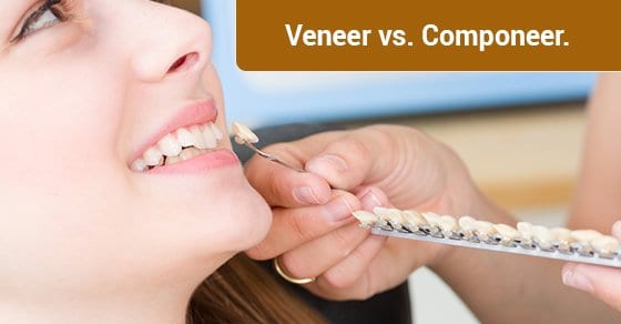 Veneer vs. Componeer