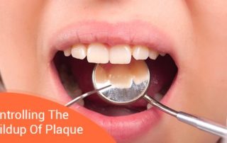 Controlling The Buildup Of Plaque