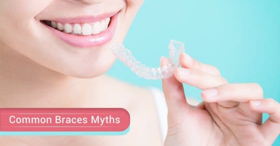 4 Common Myths About Braces Sierra Dental