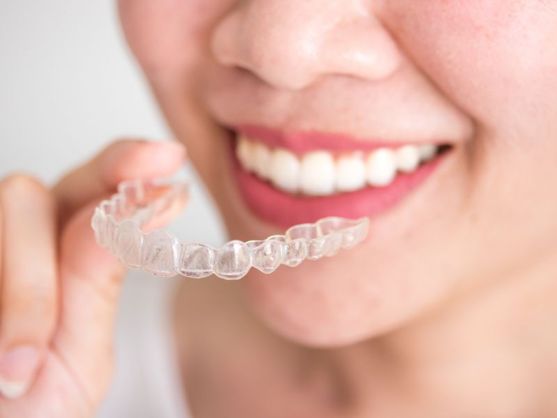 What is Invisalign