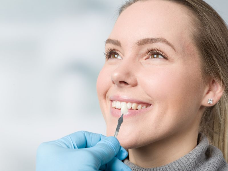 3 Ways To Finance Veneers For Your Dream Smile