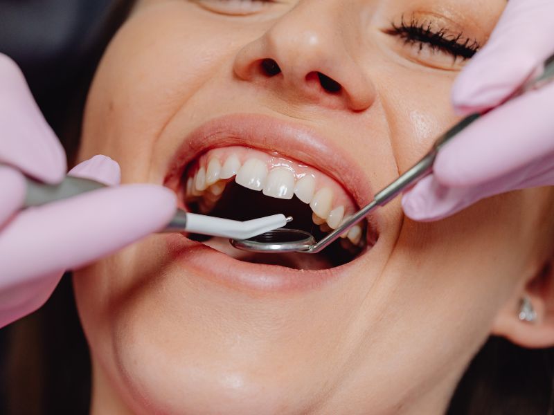 dental bonding vs. crowns72 dental bonding vs. crowns