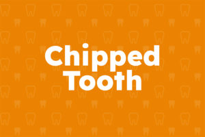 chipped-tooth-calgary