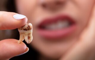 Wisdom Tooth Infection - Signs You Need Treatment