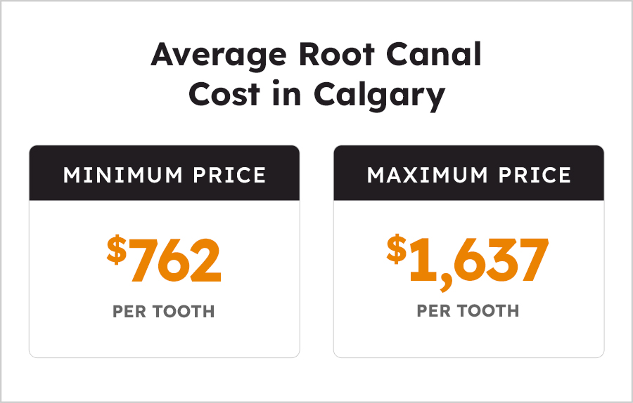 Root Canal Cost in Calgary | Sierra Dental