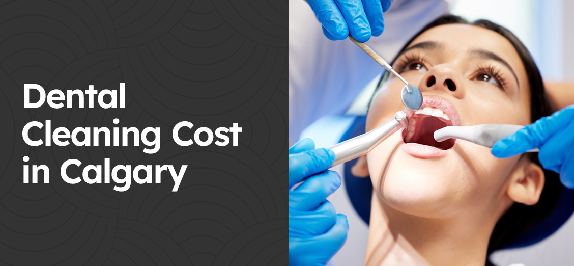 Dental Cleaning Cost in Calgary