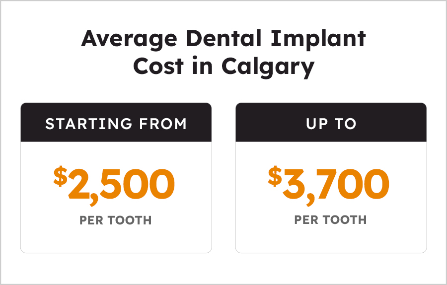 Average-Dental-Implant-Cost-Calgary