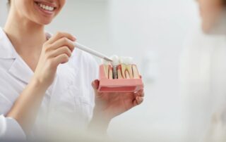 dental implants se calgary img