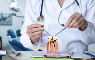 Avoid root canal