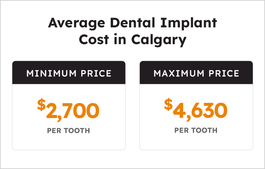 Dental Implant Cost in Calgary