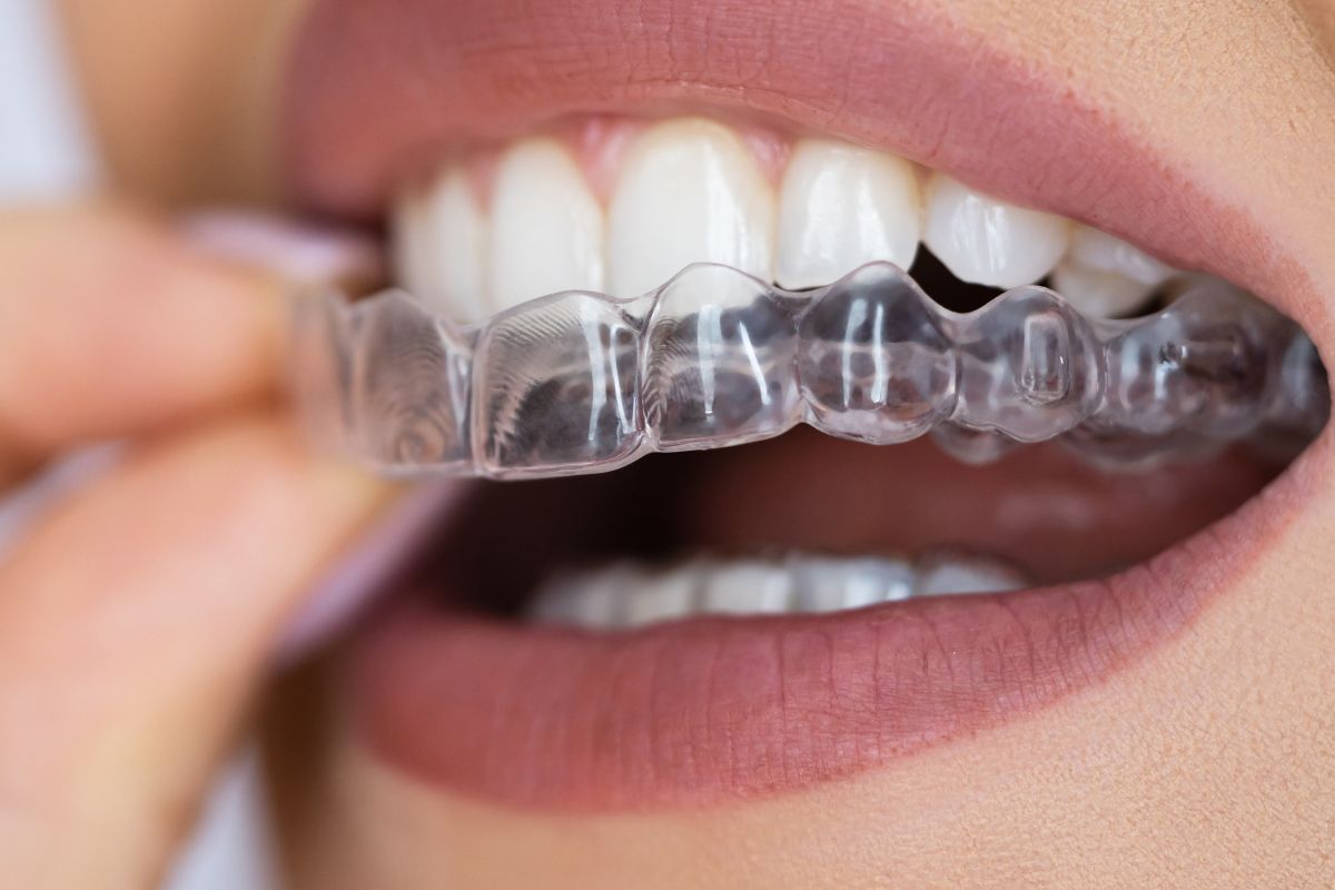ClearCorrect® braces.