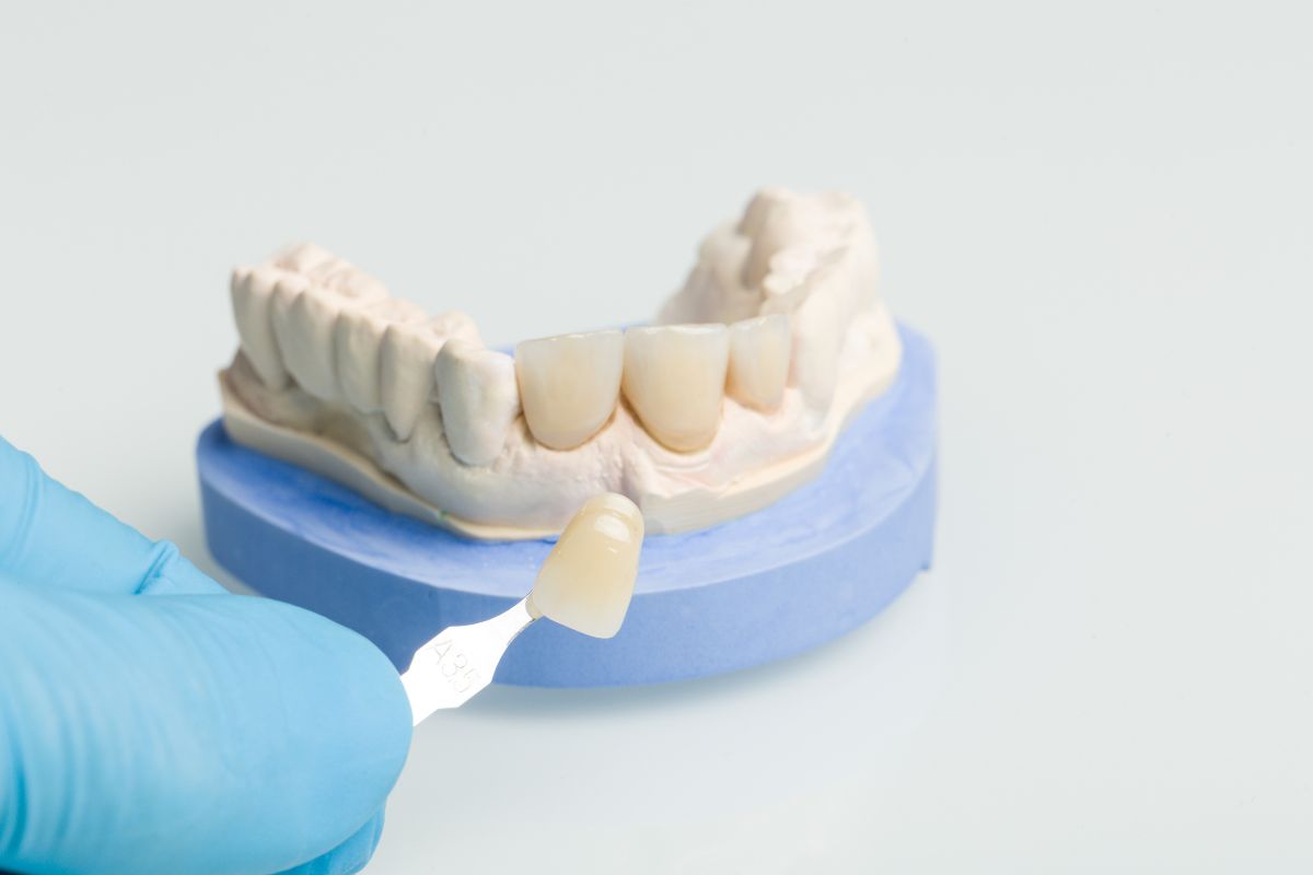Getting a dental crown.