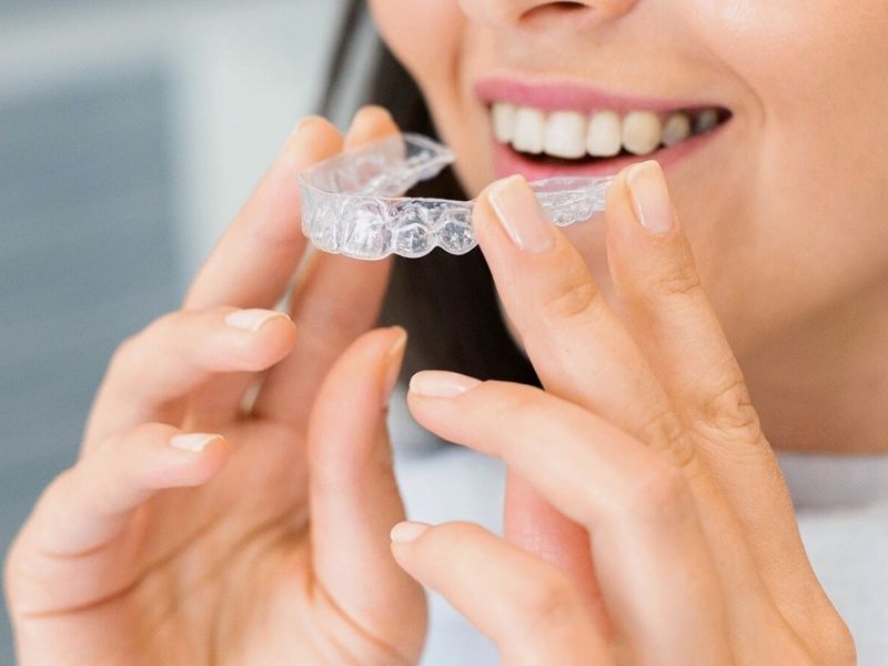 Woman holding an Invisalign clear aligner.