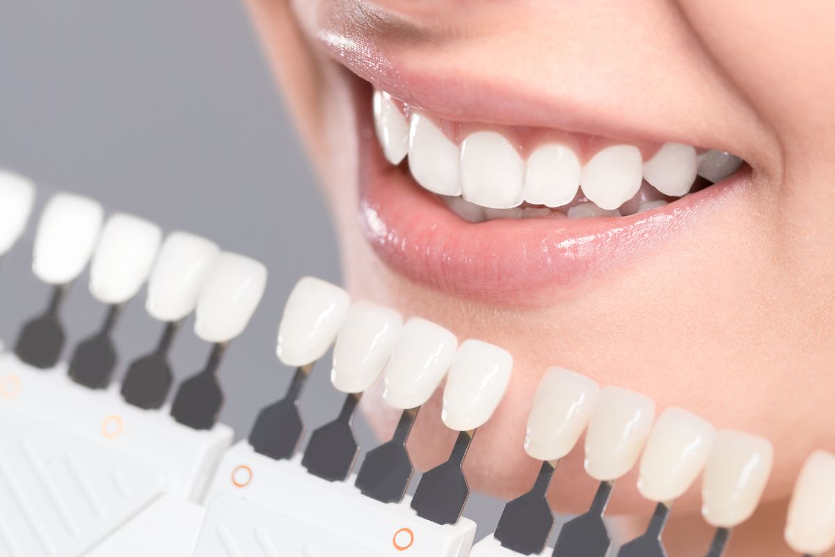 Teeth whitening treatment.