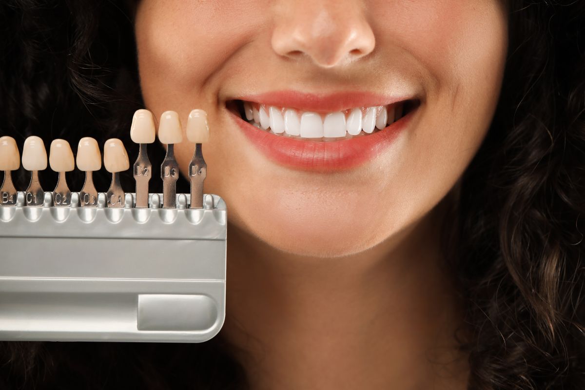 Smiling woman with teeth color samples.